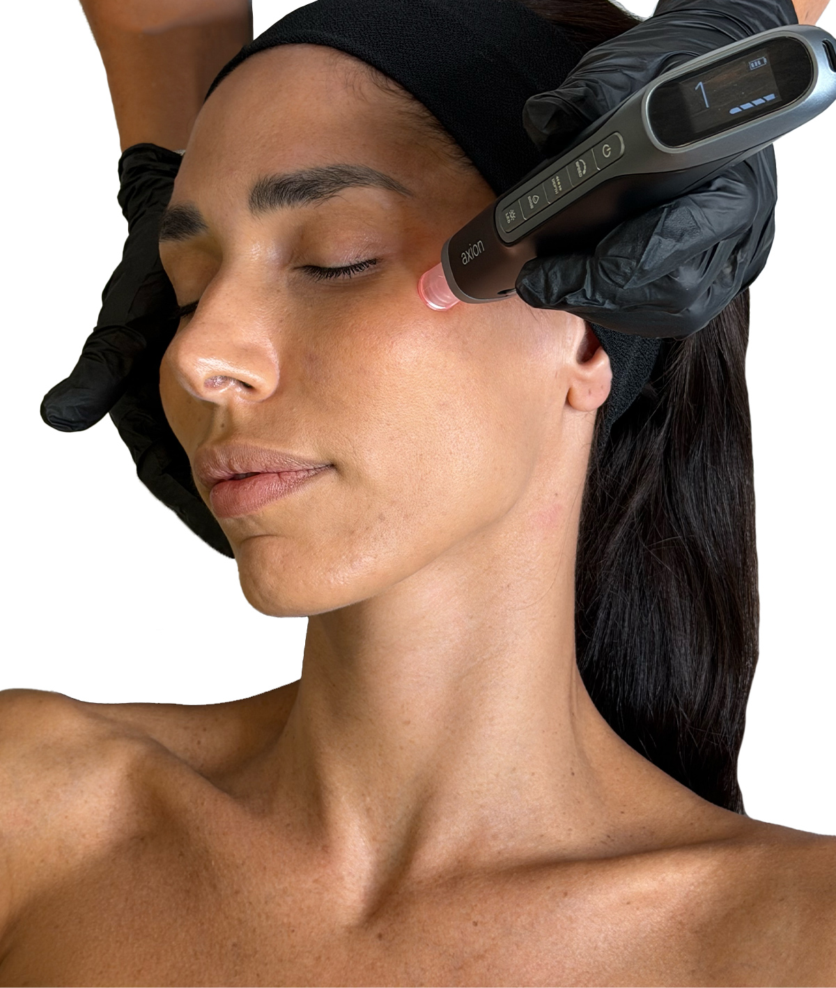 Micro Needling e Needling Viso trattamento