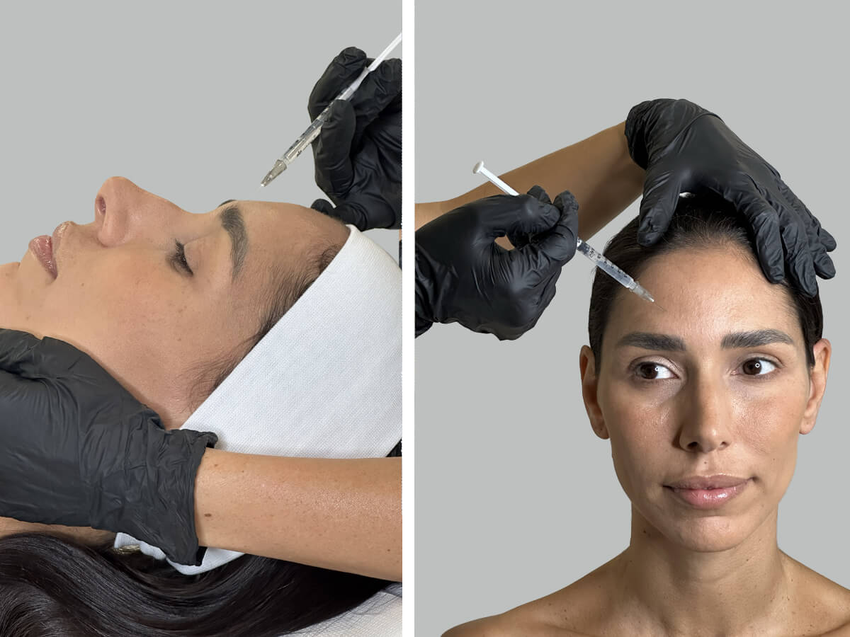 BOTOX carpi e modena